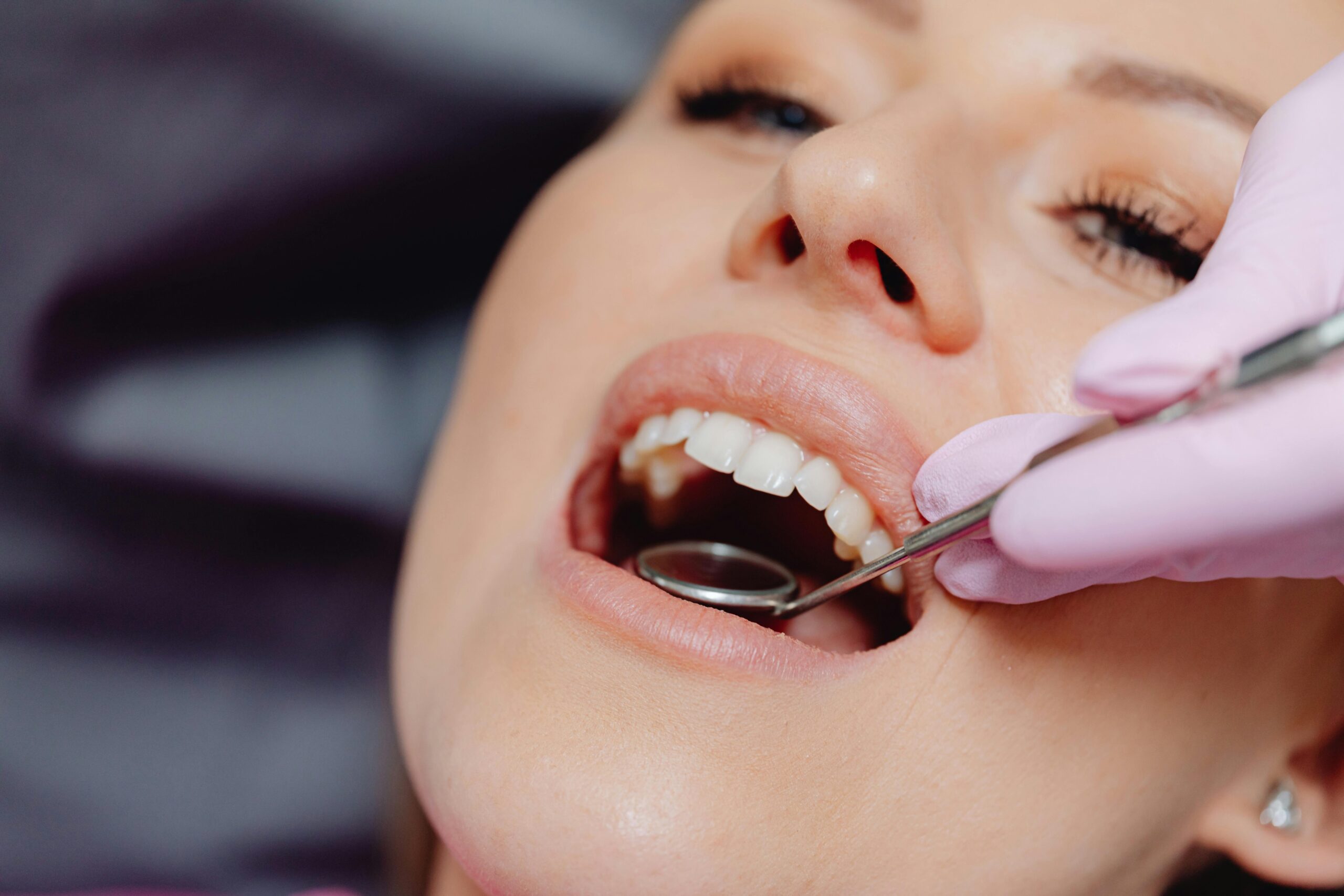 Modern Teeth Whitening Methods: A Comprehensive Guide to Changing the Colour of Your Smile