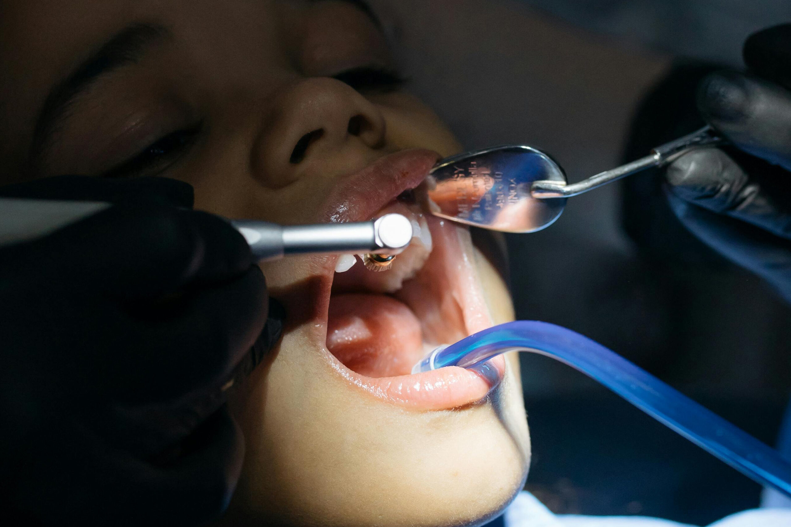 The % : Why Perth Parents Should Prioritise Paediatric Dental Care
