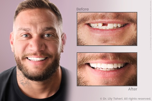 actual-patient-applecross-dentist-case-study-2