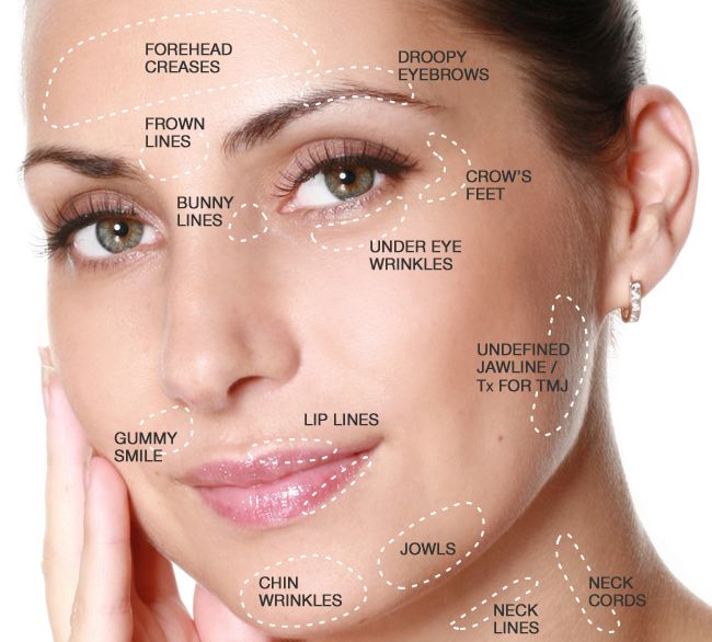 Dermal Fillers Applecross