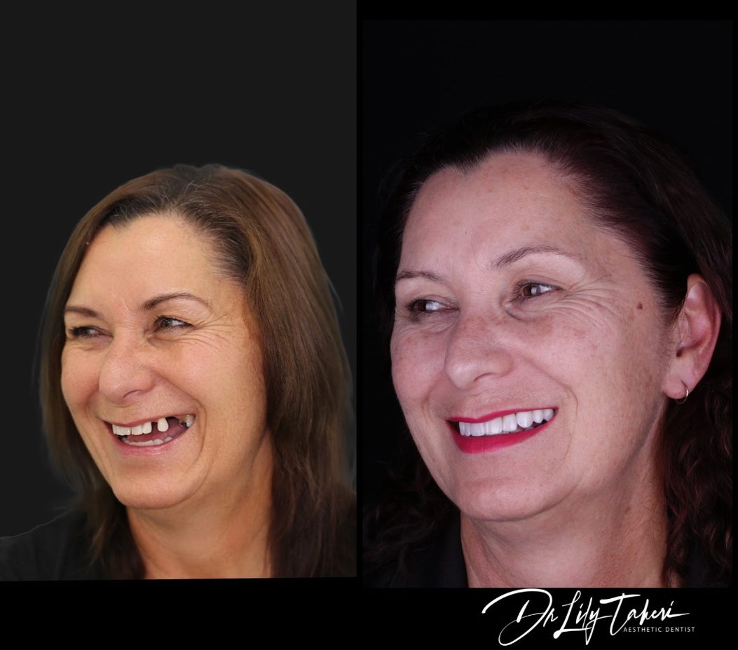 Digital Smile Design - The Applecross Dentist