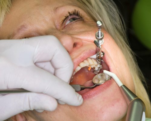 Emergency Dentist Perth