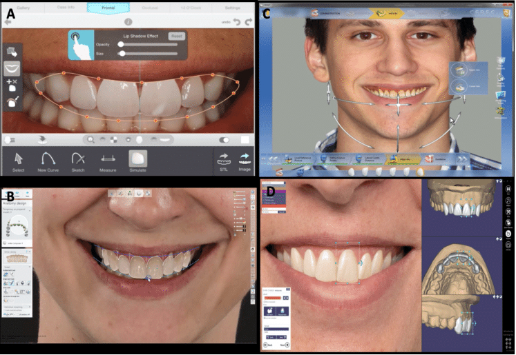 The Applecross Dentist smile-makeover-before-and-after