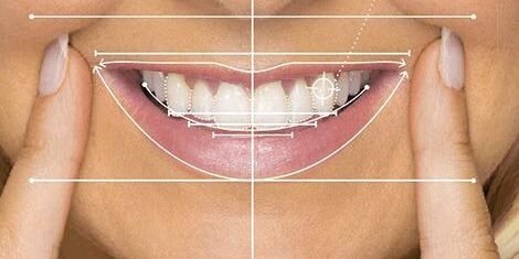 The Benefits and Limitations of Digital Smile Design (DSD)