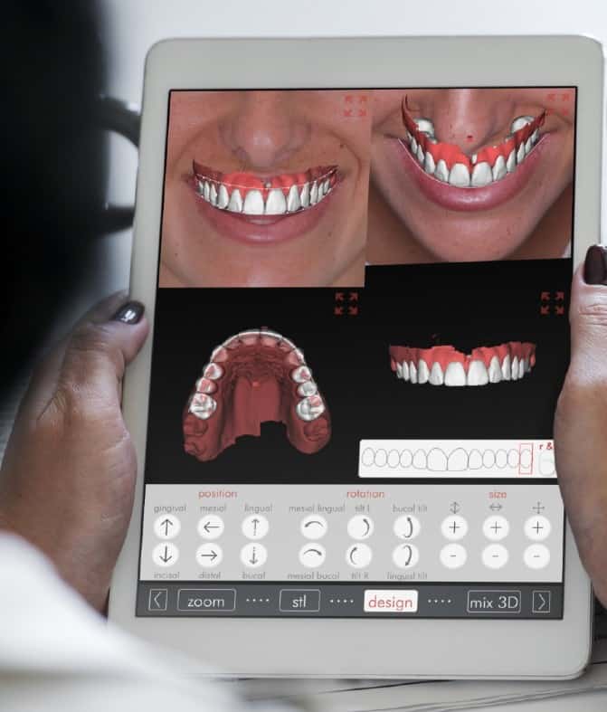 Best Cosmetic Dentist Applecross, Digital Smile design Perth