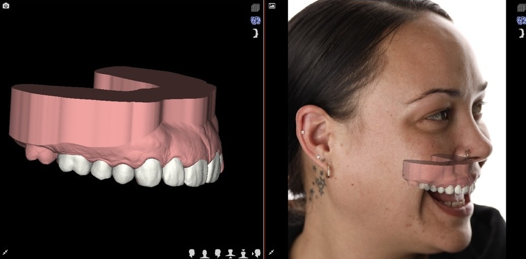 Digital Smile Design Mastery in Perth: Test Drive Your New Smile