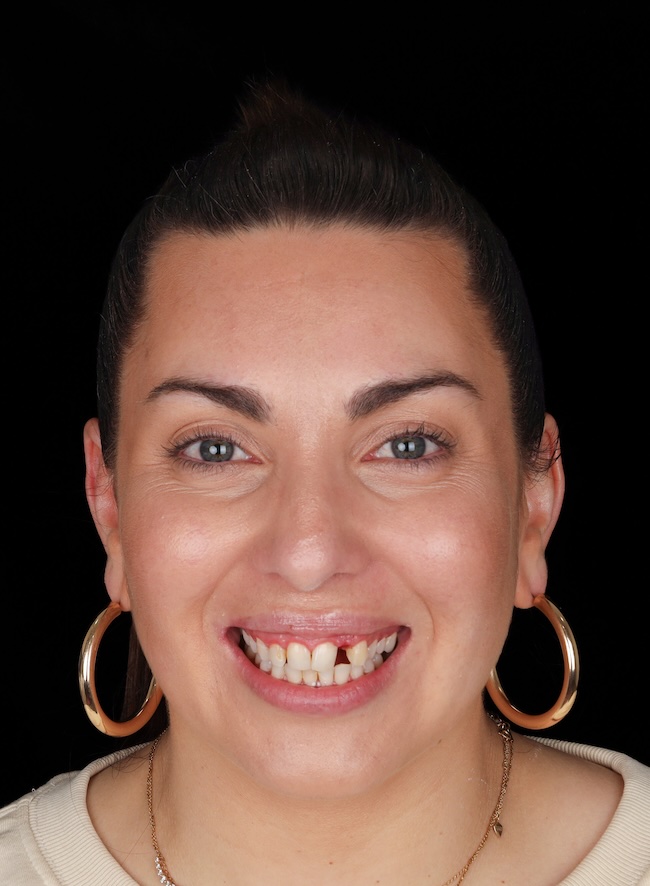 4 0
