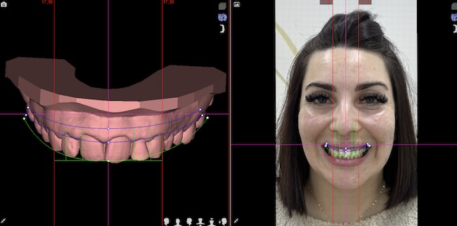 Facial Analysis