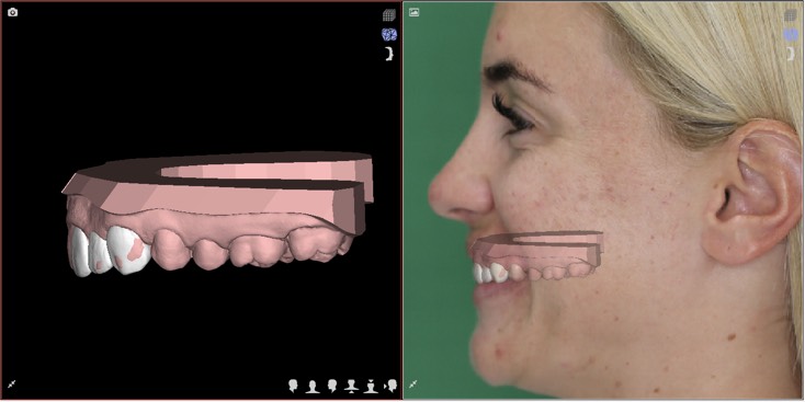 Digital smile design test drive - Yhe Applecross Dentist