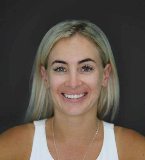 Digital smile design test - The Applecross Dentist Perth